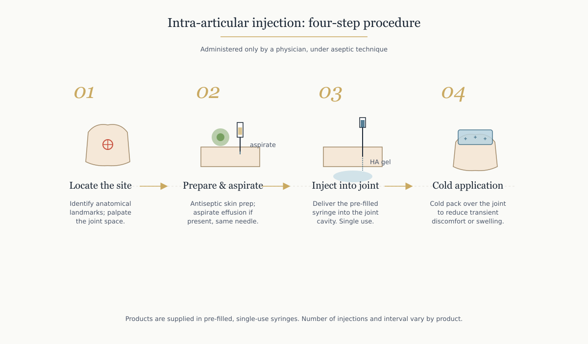 Four steps of the intra-articular injection procedure: locating the site, aseptic preparation and aspiration, injecting into the joint cavity, cold application after injection.